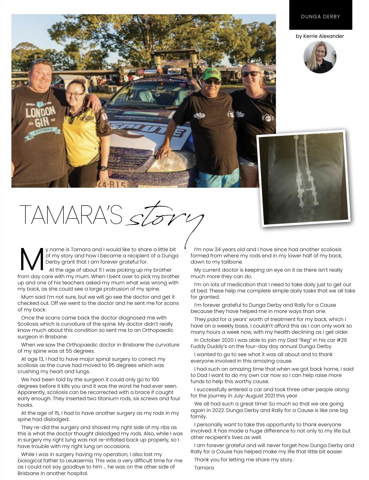 Tamara's Story